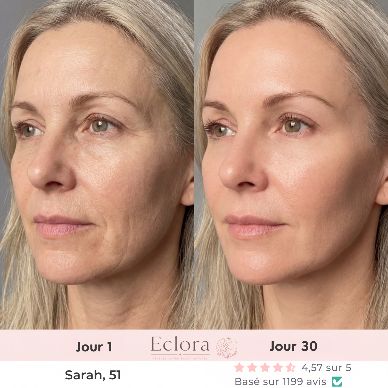Eclora Sculpteur Facial LED 7-EN-1